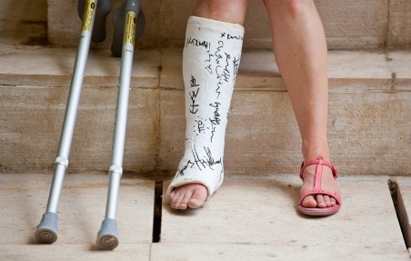 leg in cast