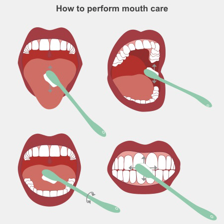 How to perform mouth care